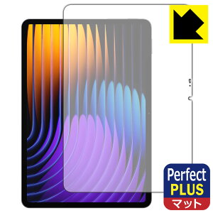 PDAH[ Xiaomi Pad 7 / Xiaomi Pad 7 Pro (11.2C`) Ή PerfectShield Plus ی tB [ʗp] ˒ጸ hw { А