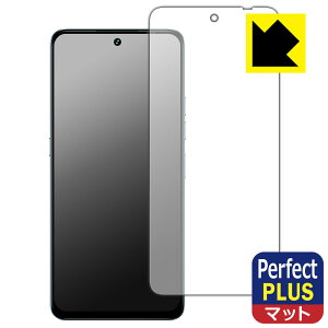 PDAH[ UMIDIGI Note 100 5G Ή PerfectShield Plus ی tB [ʗp] ˒ጸ hw { А