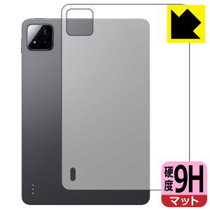 PDAH[ Xiaomi Pad 7 / Xiaomi Pad 7 Pro (11.2C`) Ή 9Hdx[˒ጸ] ی tB [wʗp] { А