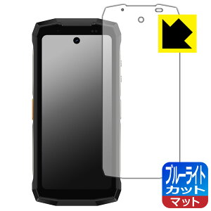 PDA�H�[ Ulefone Armor Mini 20 / Armor Mini 20 Pro �Ή� �u���[���C�g�J�b�g[���˒ጸ] �ی� �t�B���� ���{�� ���А�������