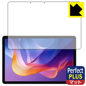 PDAH[ Xiaomi Redmi Pad 2 / Redmi Pad 2 4G / Redmi Pad 2 Play Bundle Ή PerfectShield Plus ی tB [ʗp] ˒ጸ hw { А
