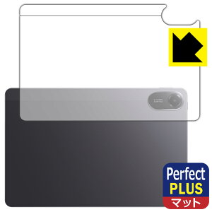 PDA�H�[ Xiaomi Redmi Pad 2 4G �Ή� PerfectShield Plus �ی� �t�B���� [�w�ʗp] [�Z�����[���f��] ���˒ጸ �h�w�� ���{�� ���А�������