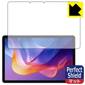 PDA�H�[ Xiaomi Redmi Pad 2 / Redmi Pad 2 4G / Redmi Pad 2 Play Bundle �Ή� PerfectShield �ی� �t�B���� [��ʗp] ���˒ጸ �h�w�� ���{�� ���А�������