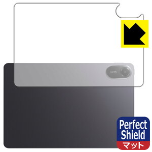 PDA�H�[ Xiaomi Redmi Pad 2 �Ή� PerfectShield �ی� �t�B���� [�w�ʗp] [Wi-Fi���f��] ���˒ጸ �h�w�� ���{�� ���А�������