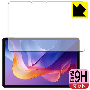 PDA�H�[ Xiaomi Redmi Pad 2 / Redmi Pad 2 4G / Redmi Pad 2 Play Bundle �Ή� 9H���d�x[���˒ጸ] �ی� �t�B���� [��ʗp] ���{�� ���А�������