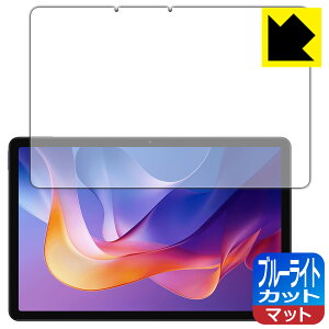 PDA�H�[ Xiaomi Redmi Pad 2 / Redmi Pad 2 4G �Ή� �u���[���C�g�J�b�g[���˒ጸ] �ی� �t�B���� ���{�� ���А�������