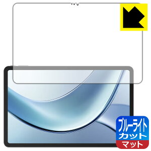 PDAH[ DOOGEE V Pad Ή u[CgJbg[˒ጸ] ی tB { А