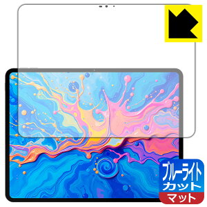 PDAH[ Teclast ArtPad Pro Ή u[CgJbg[˒ጸ] ی tB { А
