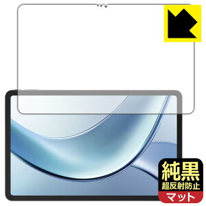 PDAH[ DOOGEE V Pad Ή NA[˖h~] ی tB ˒ጸ hw { А