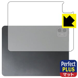 PDAH[ Teclast ArtPad Pro Ή PerfectShield Plus ی tB [wʗp] ˒ጸ hw { А