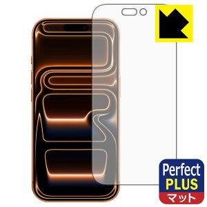 PDAH[ iPhone 17 Pro Ή PerfectShield Plus ی tB [ʗp] ˒ጸ hw { А