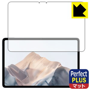 PDA�H�[ nubia Pad Pro �Ή� PerfectShield Plus �ی� �t�B���� ���˒ጸ �h�w�� ���{�� ���А�������