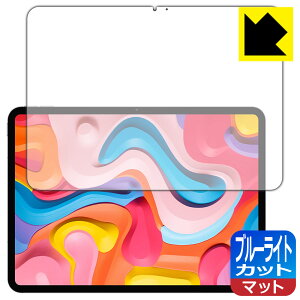 PDA�H�[ Teclast ArtPad Air �Ή� �u���[���C�g�J�b�g[���˒ጸ] �ی� �t�B���� ���{�� ���А�������