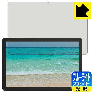 PDAH[ PHILIPS T7315 Ή u[CgJbg[] ی tB { А