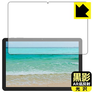 PDAH[ PHILIPS T7315 Ή e[ARᔽˁE] ی tB { А