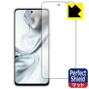 PDA�H�[ nubia S2 (A504ZT) �Ή� PerfectShield �ی� �t�B���� ���˒ጸ �h�w�� ���{�� ���А�������