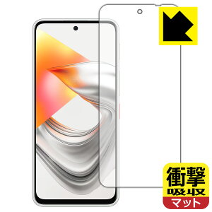 PDA�H�[ nubia S2R / S2e / S2 Lite �Ή� �Ռ��z��[���˒ጸ] �ی� �t�B���� �ϏՌ� ���{�� ���А�������