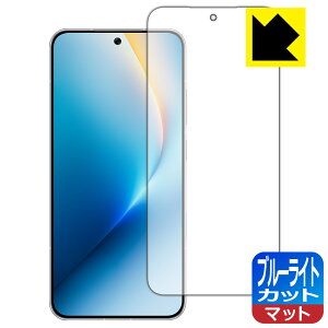 PDA�H�[ HONOR WIN RT �Ή� �u���[���C�g�J�b�g[���˒ጸ] �ی� �t�B���� [�w��F�ؑΉ�] ���{�� ���А�������