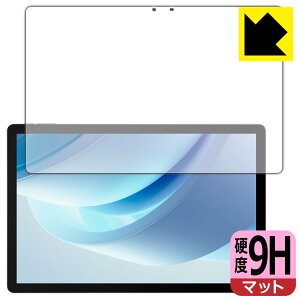 PDA�H�[ DOOGEE U13 �Ή� 9H���d�x[���˒ጸ] �ی� �t�B���� ���{�� ���А�������