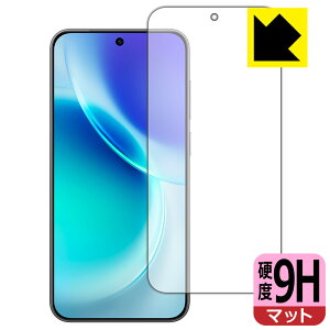 PDA�H�[ vivo X300 �Ή� 9H���d�x[���˒ጸ] �ی� �t�B���� [�w��F�ؑΉ�] ���{�� ���А�������