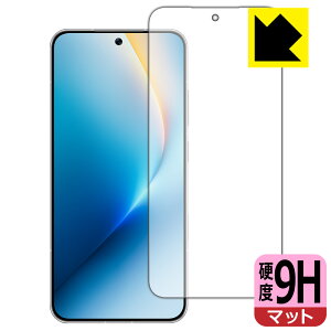 PDA�H�[ HONOR WIN RT �Ή� 9H���d�x[���˒ጸ] �ی� �t�B���� [�w��F�ؑΉ�] ���{�� ���А�������