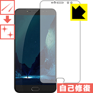 �L�Y���ȏC���ی�t�B���� UHANS Max 2 ���{�� ���А�������