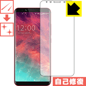 LYȏCیtB UMIDIGI S2 { А