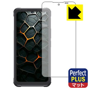 PDA�H�[ CUBOT KingKong Ace 5 �Ή� PerfectShield Plus �ی� �t�B���� ���˒ጸ �h�w�� ���{�� ���А�������