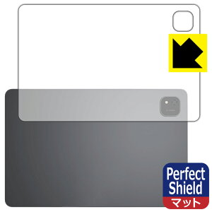 PDA�H�[ ALLDOCUBE iPlay 70 Pad Pro �Ή� PerfectShield �ی� �t�B���� [�w�ʗp] ���˒ጸ �h�w�� ���{�� ���А�������
