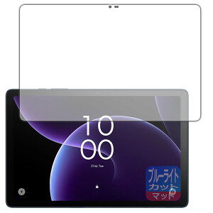 PDA�H�[ TCL TAB 10 Gen 4 (8483A) �Ή� �u���[���C�g�J�b�g[���˒ጸ] �ی� �t�B���� ���{�� ���А�������
