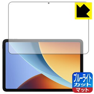 PDA�H�[ Xiaomi REDMI Pad 2 9.7 �Ή� �u���[���C�g�J�b�g[���˒ጸ] �ی� �t�B���� ���{�� ���А�������