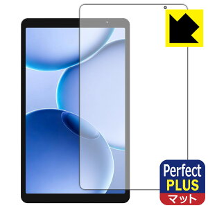 PDA�H�[ PHILIPS T7335 �Ή� PerfectShield Plus �ی� �t�B���� [��ʗp] ���˒ጸ �h�w�� ���{�� ���А�������