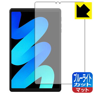 PDA�H�[ PHILIPS T7250 �Ή� �u���[���C�g�J�b�g[���˒ጸ] �ی� �t�B���� ���{�� ���А�������