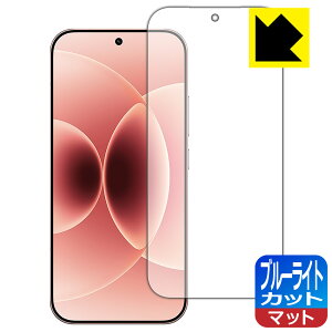 PDA�H�[ Xiaomi 17 �Ή� �u���[���C�g�J�b�g[���˒ጸ] �ی� �t�B���� [�w��F�ؑΉ�] ���{�� ���А�������