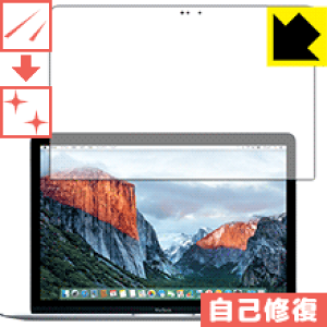 �L�Y���ȏC���ی�t�B���� MacBook 12�C���`(Retina Early 2015) ���{�� ���А�������