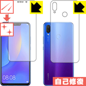 �L�Y���ȏC���ی�t�B���� �t�@�[�E�F�C HUAWEI nova 3i (���ʃZ�b�g) ���{�� ���А�������