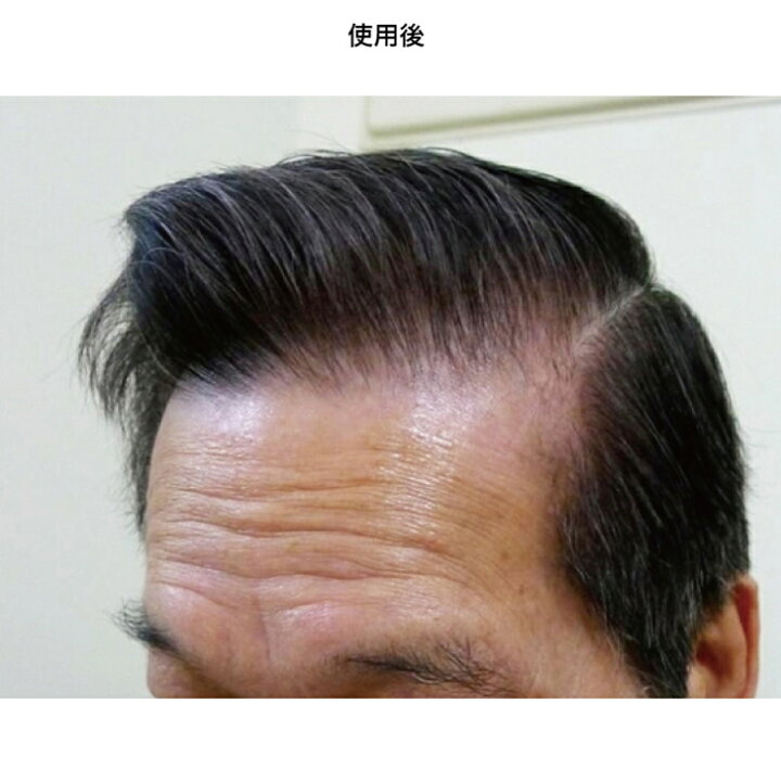 楽天市場】ルミナマジックS2 75g 光で染める白髪染め アウラ ルミナ  