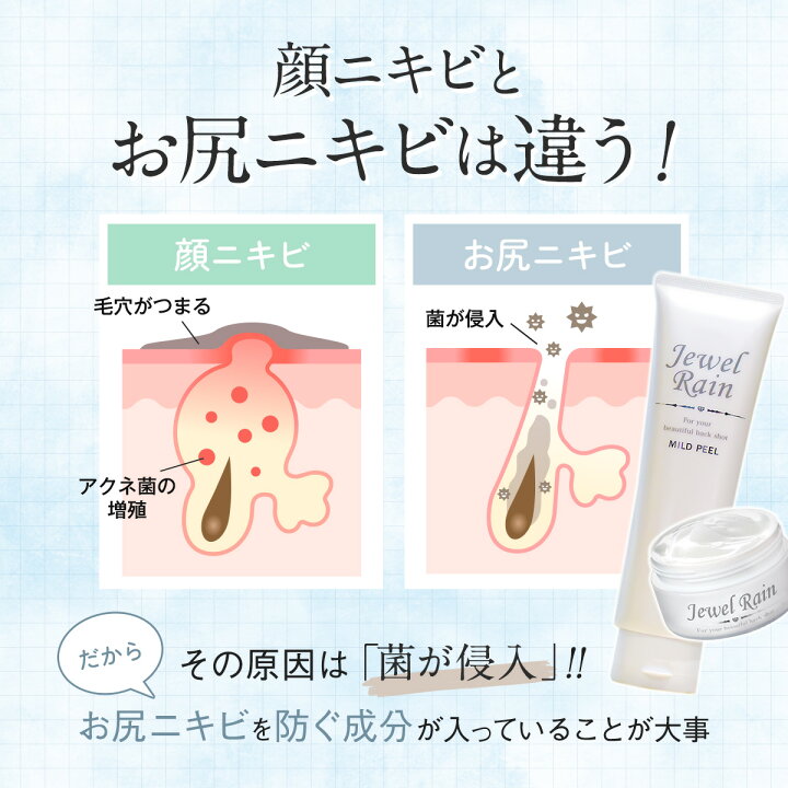 背中ケア 背中ニキビ ニキビ跡 石鹸 美白クリーム クレーター肌 身体 メンズ 大人 保湿 ソープ ぶつぶつ ニキビ おしり 体 吹き出物 ボディー デコルテ 肌荒れ にきび クリーム 薬用