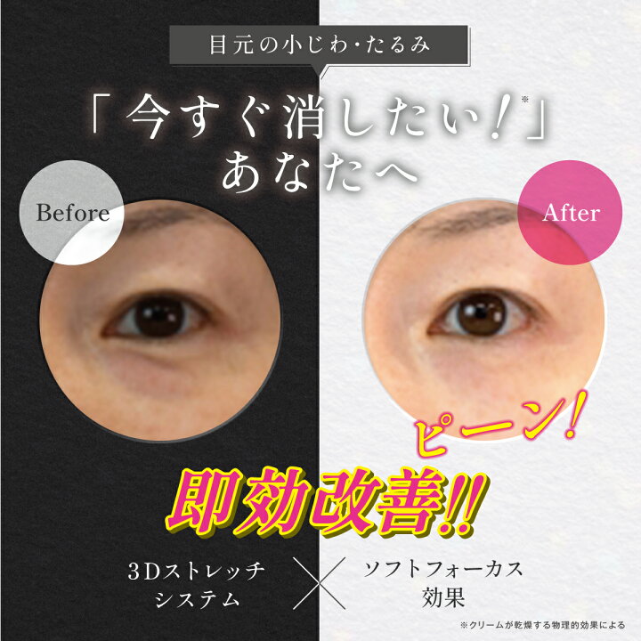 楽天市場】目の下 たるみ 目元 たるみ隠し 小じわ アイクリーム ハリ  