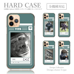 X}zP[X Redmi Note 11 Pro Redmi Note 10 Pro 10JE 9T 9S Xiaomi Mi 10 Lite 5G VI~ h~ P[X VI~ P[X Jo[  ؍  lC l^ S q