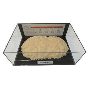 ���b�͌^�t�B�M���A�P�[�X�� 3kg IP-980