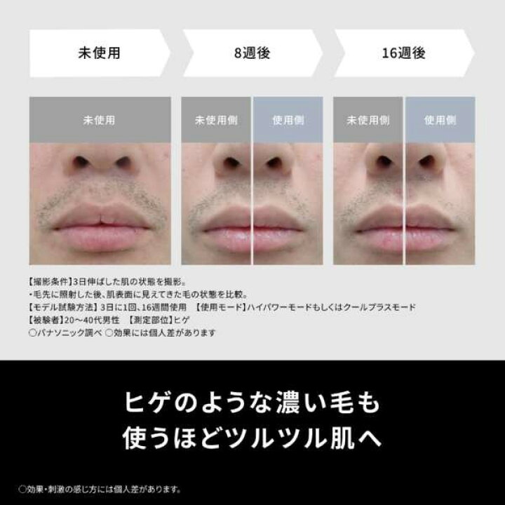 楽天市場】ES-WG0B-H PANASONIC グレー 光エステ スムースエピ パワー 