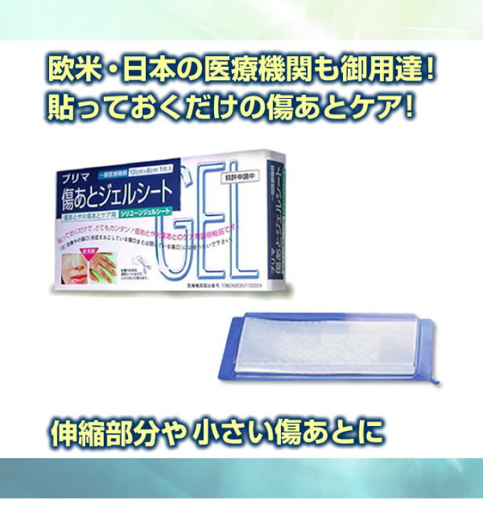 楽天市場】【ポイント10倍】【クーポンあり】【メール便対応】【送料無料】傷跡 やけど 手術痕 プリマ傷あとジェルシート : プロフィット楽天市場店 楽天市場】【ポイント10倍】【クーポンあり】【メール便対応】【送料無料】傷跡 やけど 手術痕 プリマ傷あとジェルシート : プロフィット楽天市場店