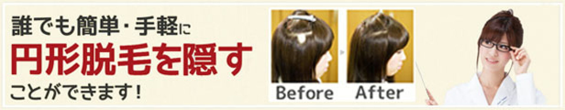 円形脱毛を隠すことができます