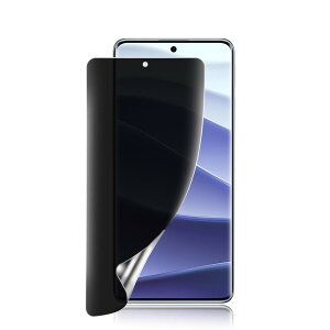 Redmi Note 14 ro 5G �ی�t�B���� �� �`�����h�~ TPU�f�� ���b�h�~�[ Note 14 Pro 5G �ی�t�B���� �̂������h�~�t�B���� �\��t���ȒP/�C�A�Ȃ�/�w��h�~/�X�N���b�`�h�~/�����ɂ���/�v���C�o�V�[