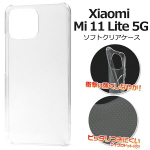  Xiaomi Mi 11 Lite 5G }CNhbg \tgNAP[X VI~ simt[ Vt[ IIJmio OCNoC }ClI 2020N9f P[X Jo[ Vv X}zJo[ X}zP[