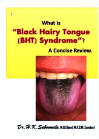 What is “Black Hairy Tongue (BHT) Syndrome”? A Concise Review.【電子書籍】[ Dr. Hakim. K. Saboowala ]