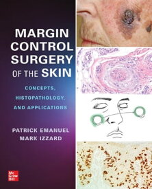 Margin Control Surgery of the Skin: Concepts, Histopathology, and Applications【電子書籍】[ Patrick Emanuel ]