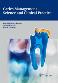 Caries Management - Science and Clinical Practice【電子書籍】