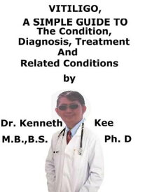 Vitiligo, A Simple Guide To The Condition, Diagnosis, Treatment And Related Conditions【電子書籍】[ Kenneth Kee ]